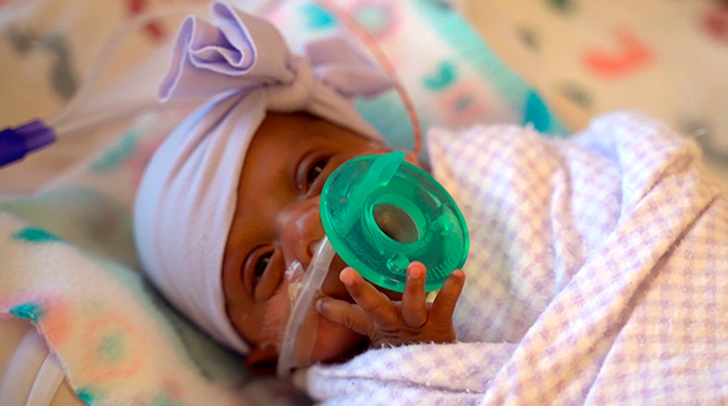 (Sharp HealthCare via AP) This March, 2019 photo provided by Sharp HealthCare in San Diego shows a baby named Saybie. Sharp Mary Birch Hospital for Women & Newborns said in a statement Wednesday, May 29, 2019, that Saybie, born at 23 weeks and three days, is believed to be the world's tiniest surviving baby, who weighed just 245 grams (about 8.6 ounces) before she was discharged as a healthy infant. She was sent home this month weighing 5 pounds (2 kilograms) after nearly five months in the hospital's neonatal intensive care unit.