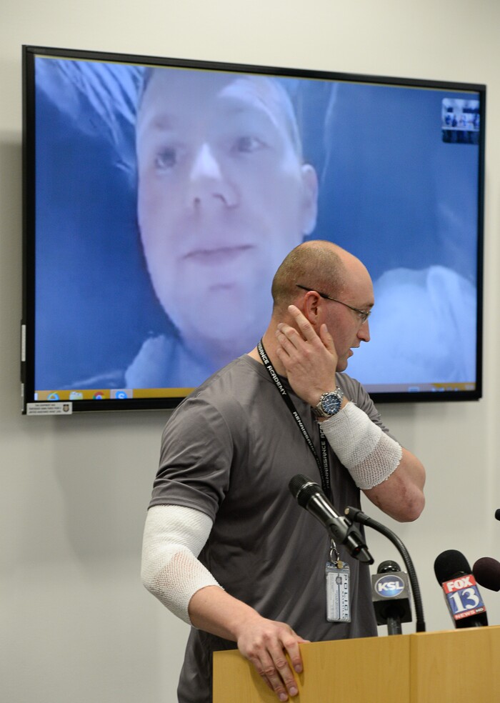 (Francisco Kjolseth  |  The Salt Lake Tribune)  Officer Cade Bradshaw describes some of the burns he sustained as fellow officer Robert Jackson, appearing via video, recovers at the University hospital burn unit. Both officers were injured while responding to a call on April 5, 2018, when a man entered a Chevron gas station store and doused himself with gasoline. As the officers tried to get a lighter from the manÕs hand, the man lit himself on fire.