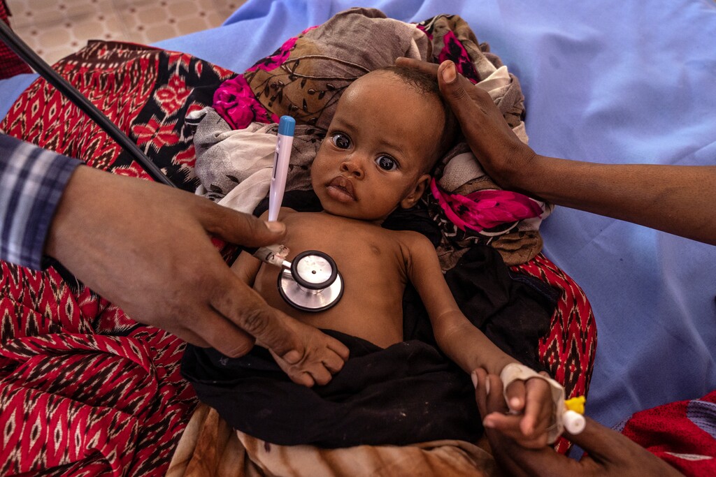 (Giles Clarke | The New York Times)

A doctor at the Trocaire referral hospital monitors the heart rate of a malnourished baby in Doolow, Somalia on Jan. 10, 2023.