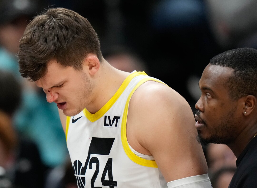 (Francisco Kjolseth  |  The Salt Lake Tribune) Utah Jazz center Walker Kessler (24) leaves the court with blood on his face as the Utah Jazz host the Cleveland Cavaliers at the Delta Center in Salt Lake City on Tuesday, April 2, 2024.