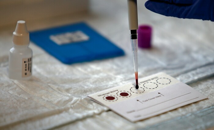 (Luis Sánchez Saturno | Santa Fe New Mexican | The Associated Press) In this Wednesday, April 25, 2018 photo, Tamara Flys, director of research at Southwest Care in Santa Fe, N.M., prepares dried blood spots with a patient's blood sample to be sent out for testing. The HIV/AIDS clinic has been at the forefront of AIDS research over the past 30 years.